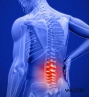 Back Pain Treatment in Pimpri Chinchwad | Lower Back Pain Treatment in Pune 