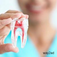 Root Canal Treatment in Koregaon Park | The Smile Studio 