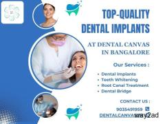 Top-Quality Dental Implants in Bangalore | Dental Canvas