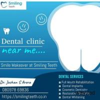 Get Exceptional Dental Services Near Mira Road at Smiling Teeth