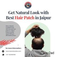 Get Natural Look with Best Hair Patch in Jaipur