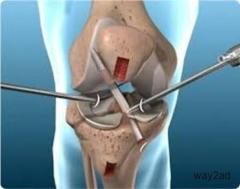 Best Orthopedic Surgeon in Indore - dr. Sanjay Rawat 